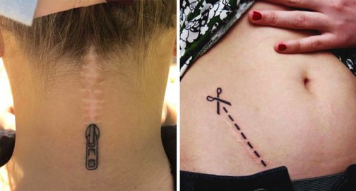 Tattoo Auf Narbe Tattoo Auf Narbe